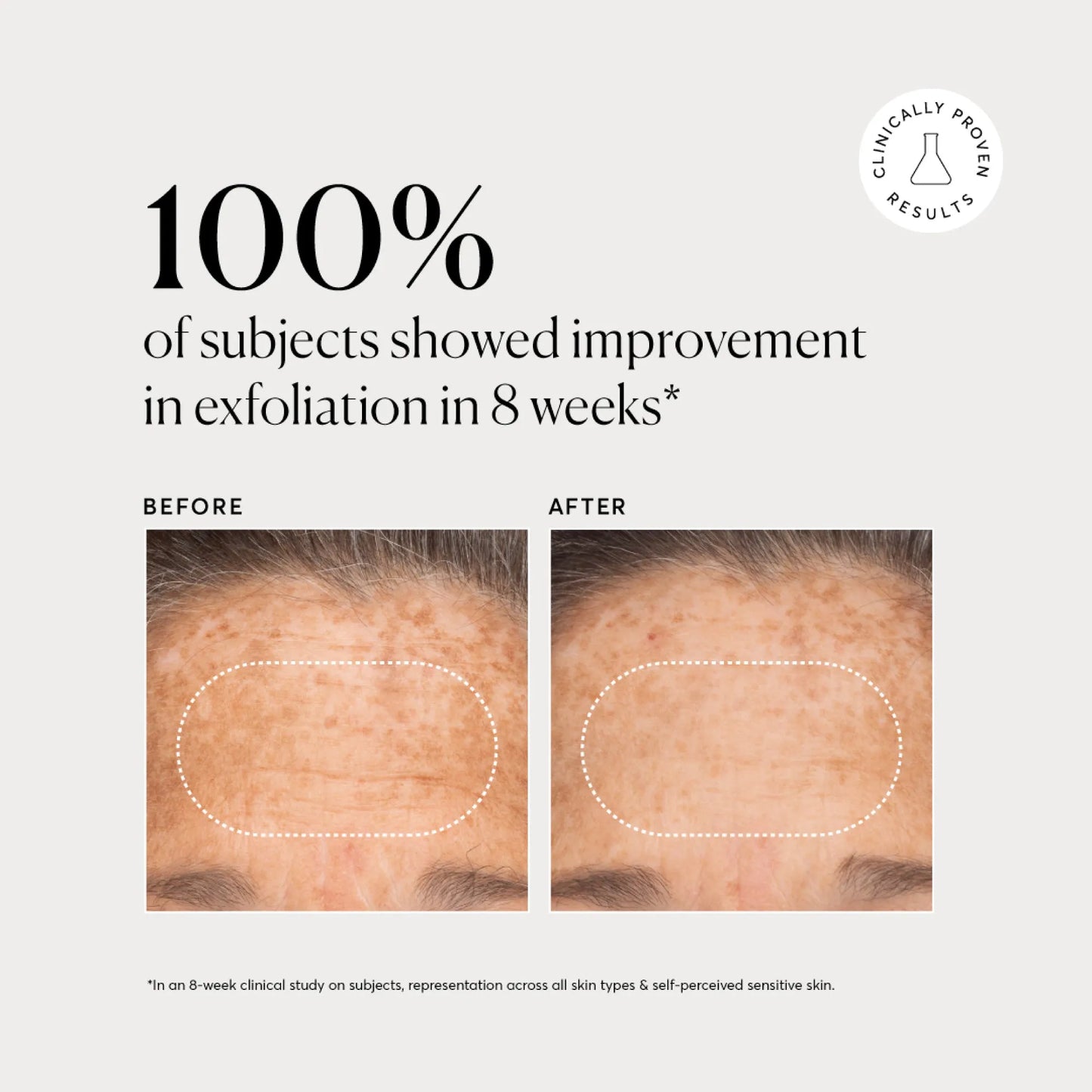 bha-liquid-exfoliant-2-x2 NATR-10027-Alt-Images-BHA-Liquid-Exfoliant-2_-03.webp