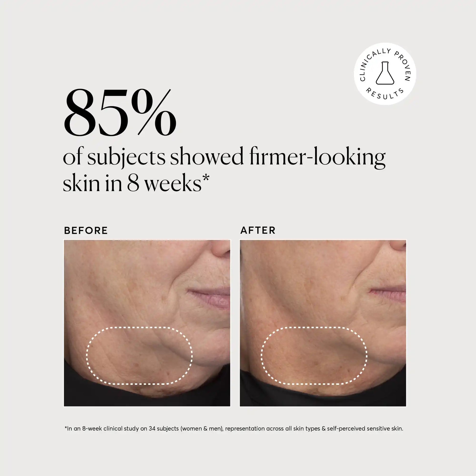 retinol-complex-serum-j3 NATR-10034-Alt-Images-Retinol-Complex-Serum-04.webp
